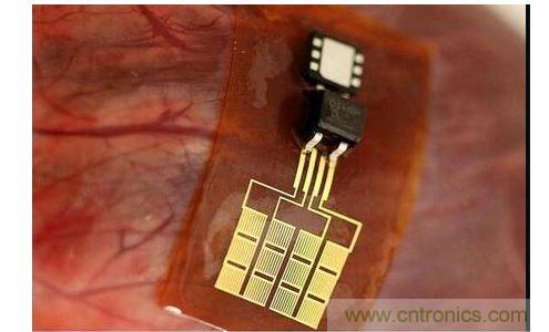 可將人體變成電腦的電子皮膚!