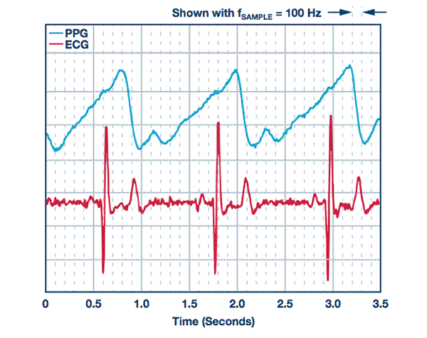 從可穿戴設備過渡到醫療設備 從可穿戴設備過渡到醫療設備